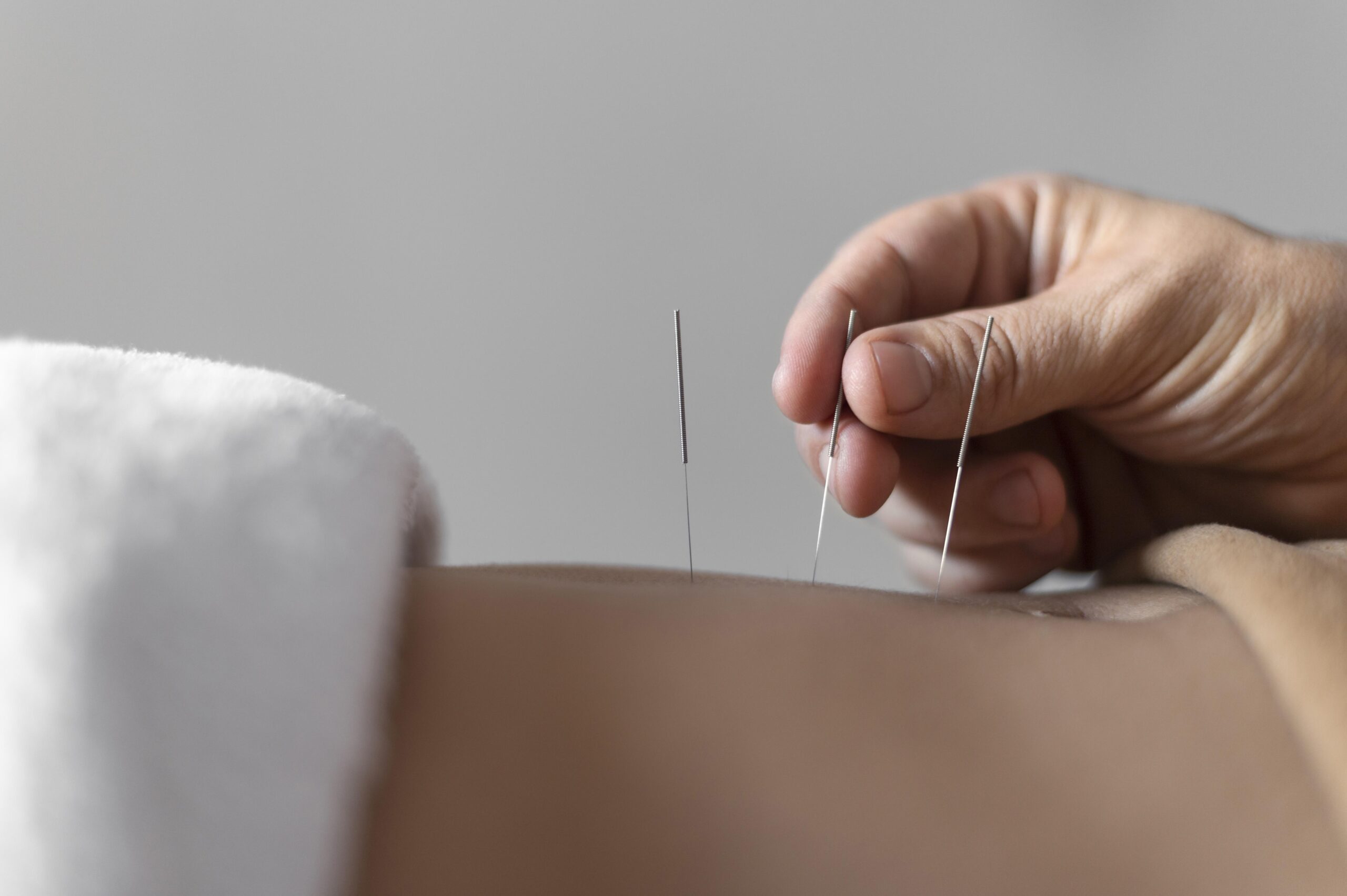 GL Acupuncture